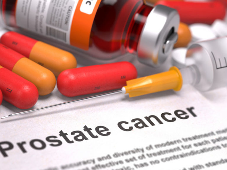 New Prostate Cancer Drug Unlocks Key Treatment The Citizen 6015