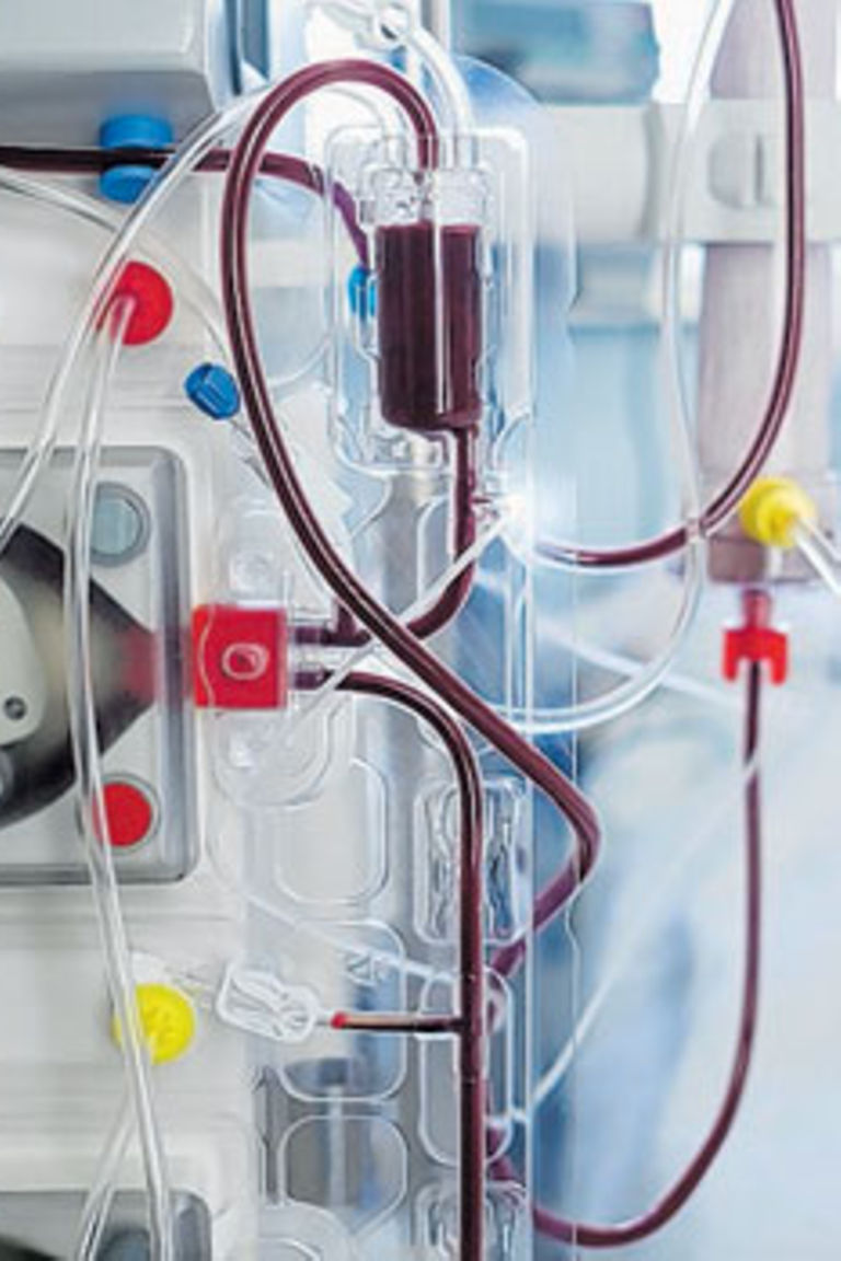 Breaking barriers to dialysis treatment - The Citizen